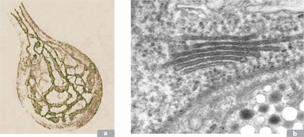 Micrografía con el microscopio eléctronico