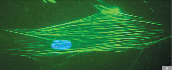 Epifluorecencia
